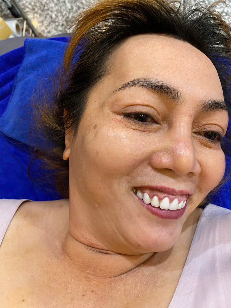 Lợi ích của làm trẻ hoá da