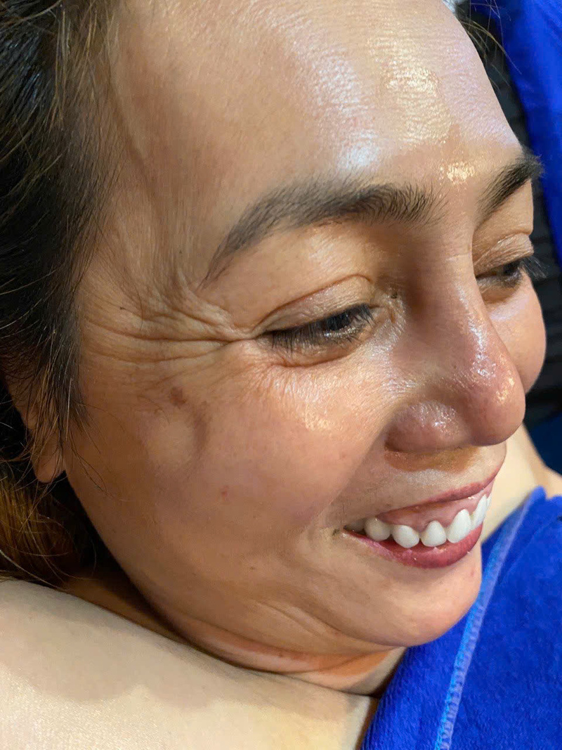 Ai phù hợp với trẻ hoá da